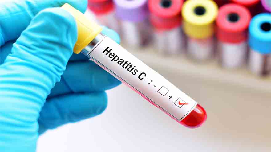 The toll of hepatitis in Pakistan